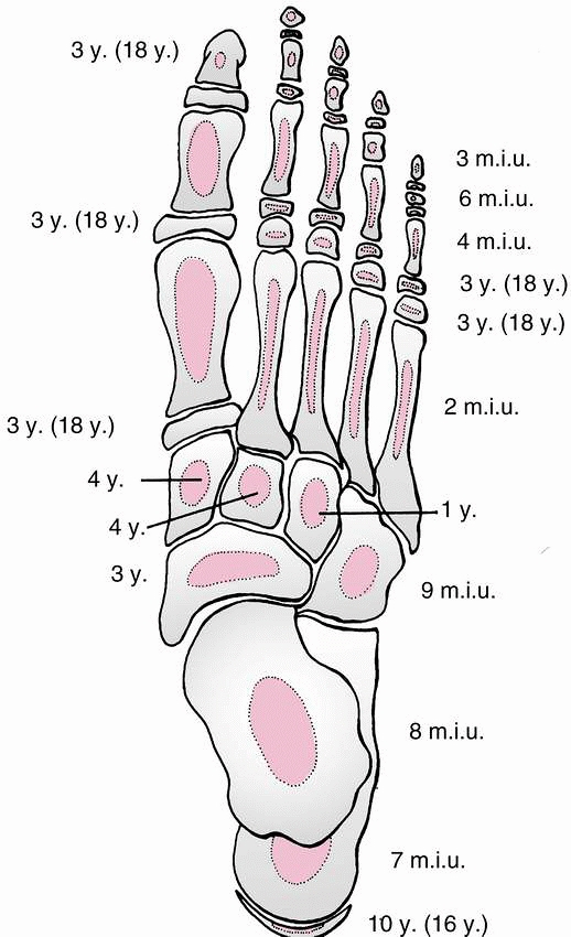 Fractures And Dislocations Of The Foot TeachMe Orthopedics