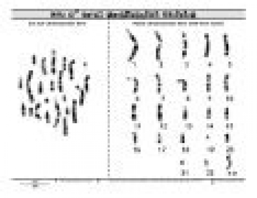 Cut N Paste Karyotyping Activity Genetic Science Learning Center