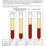 Investigation Hematocrit Updated 1ANSWERS docx Name Date